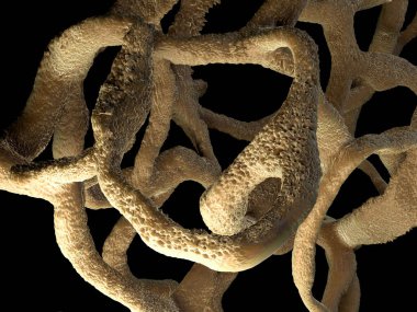 Osteoporotik kemik, sağlıksız kemik yapısı yakın çekim