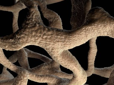 Osteoporotik kemik, sağlıksız kemik yapısı yakın çekim