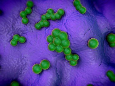 süperböcek veya Staphylococcus aureus (MRSA) bakterisi