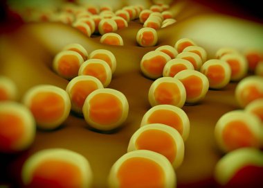 süperböcek veya Staphylococcus aureus (MRSA) bakterisi