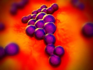 süperböcek veya Staphylococcus aureus (MRSA) bakterisi