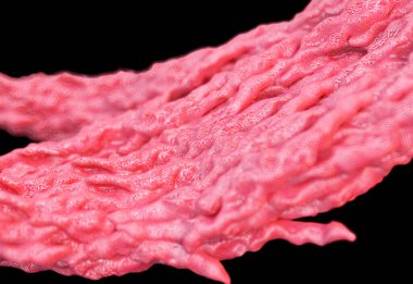 Tüberküloz bakterisi, yakın görüş