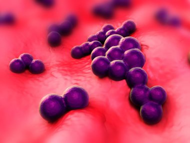 süperböcek veya Staphylococcus aureus (MRSA) bakterisi