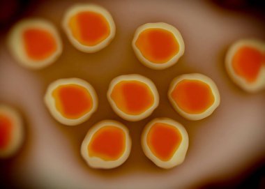 süperböcek veya Staphylococcus aureus (MRSA) bakterisi