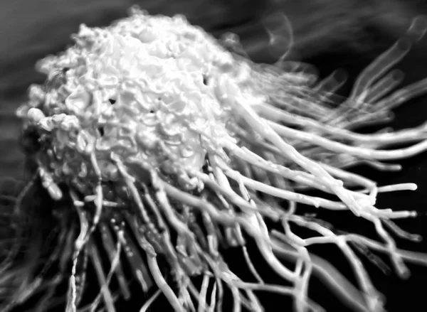 Primer Plano Las Células Cancerosas — Foto de Stock