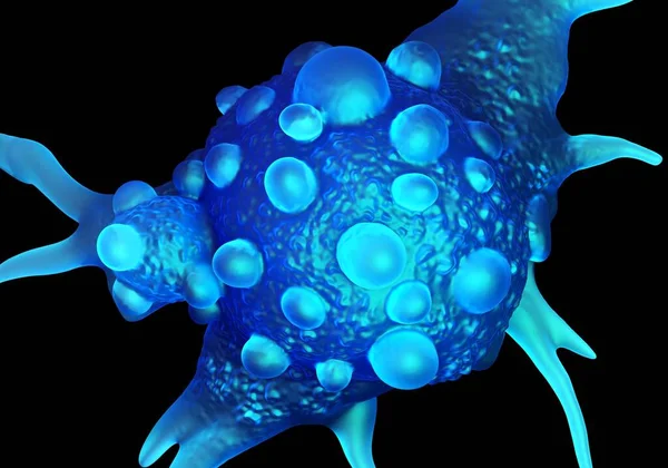 3Dイラスト 膀胱がん細胞 — ストック写真