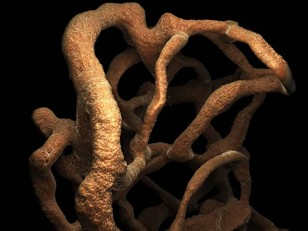 Osteoporotik kemik, sağlıksız kemik yapısı yakın çekim