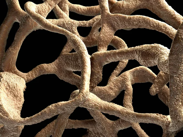 Osteoporotik kemik, sağlıksız kemik yapısı yakın çekim