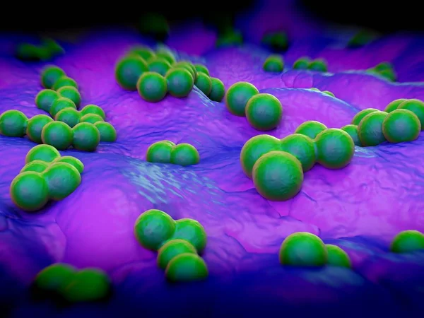 süperböcek veya Staphylococcus aureus (MRSA) bakterisi