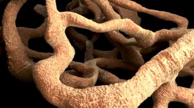 Osteoporotik kemik, sağlıksız kemik yapısı yakın çekim