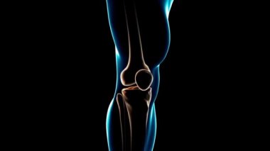 İnsan anatomik diz ağrısı