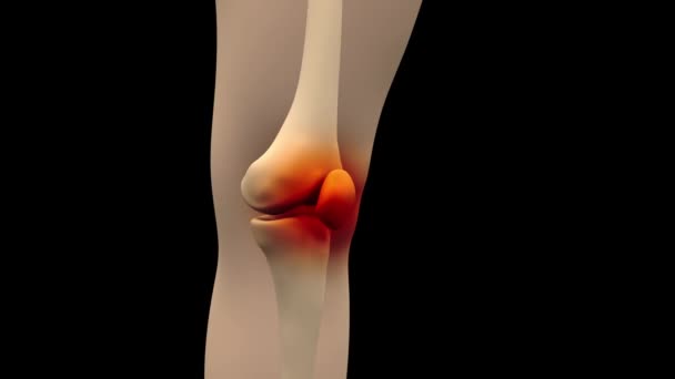 Dolor Anatómico Humano Rodilla — Vídeo de stock