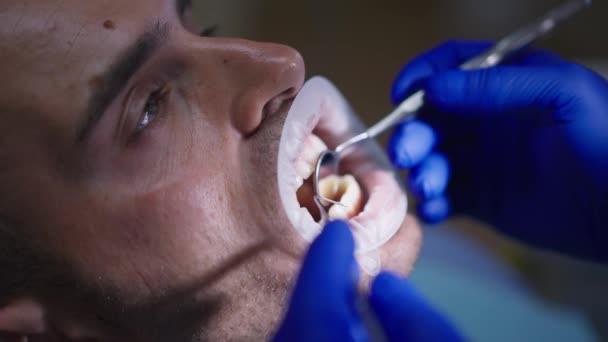 Detailní záběr na mužského pacienta s rukama nerozpoznatelného zubaře, který používá ústní zrcátko a zubní sondu ve zpomaleném pohybu. Kavkazský muž poradenství profesionální ortodontista v nemocnici uvnitř. — Stock video