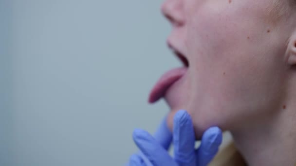 Sidovy närbild kvinnlig mun med tungan ut och läkare hand sätter engångs spatel. Oigenkännlig tonåring kaukasiska flicka genomgår läkarundersökning på kliniken. Begreppet tolaryngologi. — Stockvideo