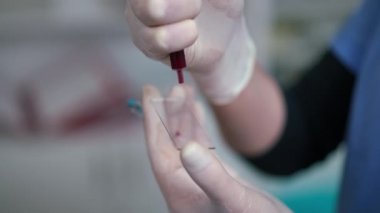 Camdan mikroskoba damlayan hayvan kanı veteriner kliniğinde yavaş çekimde kayıyor. Tanımlanamayan beyaz kadın içeride yapılacak laboratuvar muayenesi için örnek hazırlıyor. Hayvanlar bakım konsepti