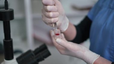 Yakın plan tıbbi tuz solüsyonunu cam kaydırakta analiz için kan örneğiyle birlikte damlatıyor. Laboratuvarda mikroskop altında yavaş çekimde incelenmek üzere tanımlanamayan bir numune hazırlıyor.