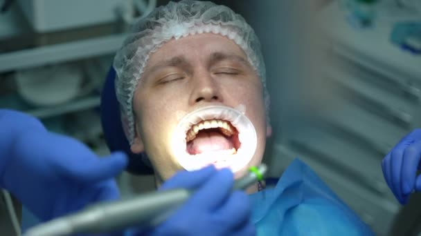 Twarz Pacjenta Zamkniętymi Oczami Fotelu Dentystycznym Jako Lekarz Pielęgniarka Wiertłem — Wideo stockowe
