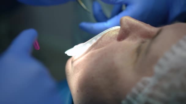 Close Caucasian Man Dental Chair Doctor Assistant Using Dental Scissors — Stock video