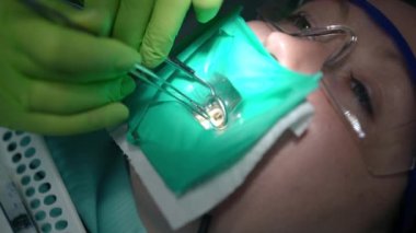 Diş hekimi elleriyle diş macunu temizleyen ve diş aynasına yansıyan genç bir kadının yakın çekimi. Diş sandalyesinde oturan beyaz bir hastanın portresi. Diş tedavisi için tanınmayan bir doktor.