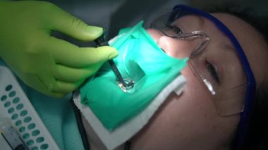 Diş sandalyesindeki hastanın kök kanalına protektör yerleştiriyorum. Kafkas kadının diş barajında portresi ve hastanede endodontik tedavi gören gözlük. Yavaş çekim