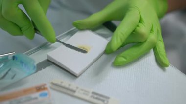 Diş asistanı elleri, dolgu malzemesiyle diş spatulasını yavaş çekimde karıştırıyor. İçeride ortodontik klinikte çalışan tanınmayan beyaz kadın. Tıp ve dişçilik kavramı