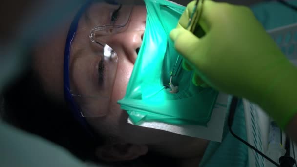 Nahaufnahme Der Wurzelkanalakte Zahnkanal Des Patienten Der Stomatologischen Klinik Unerkennbarer — Stockvideo
