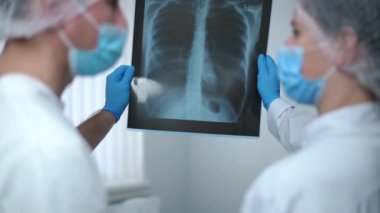 Lungs X-ray in hands of professional doctor and nurse talking analyzing test result. Shooting over shoulder of expert Caucasian man and woman in uniform and face masks discussing diagnosis in hospital