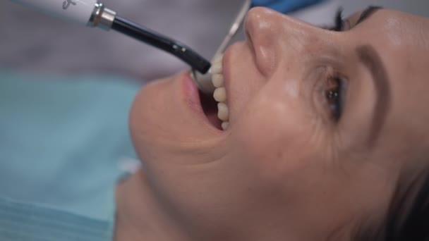 Close Caucasian Woman Open Mouth Unrecognizable Dentist Turning Penlight Using — Stock video