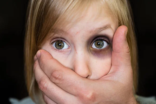 Child Abuse Violence Concept Scared Young Girl Mouth Closed Adult — стоковое фото