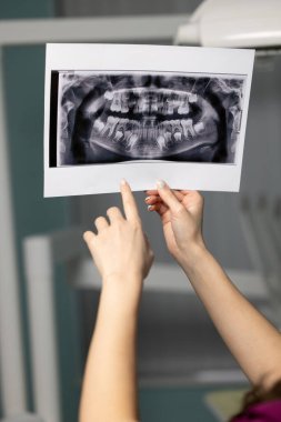 Diş muayenehanesinde ellerinde diş taramaları olan güzel bir kadın doktor.