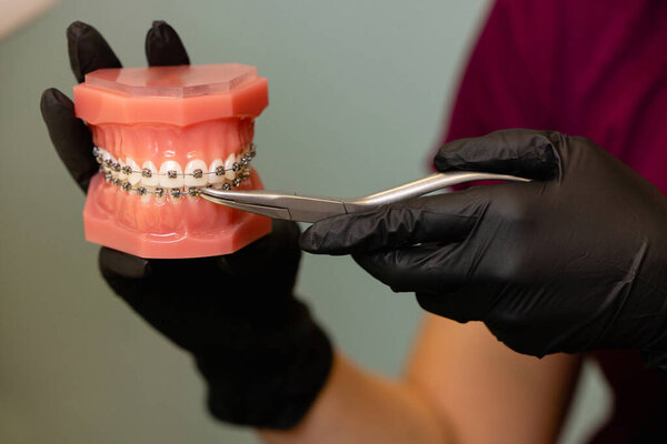  Close-up shot of doctors hands in black gloves holding models of teeth with ceramic braces on teeth on an artificial jaw. 