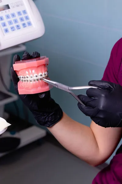 Close-up tiro de médicos mãos em luvas pretas segurando modelos de dentes com aparelho cerâmico em dentes em uma mandíbula artificial. — Fotografia de Stock