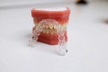 Ağız koruyucusu ve diş modelleri bir çenede