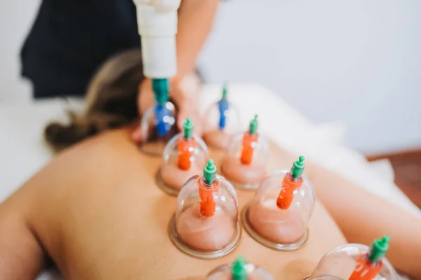 Ventosas colocadas en la espalda de una paciente, por un masajista. Centro de masajes de spa médico. —  Fotos de Stock