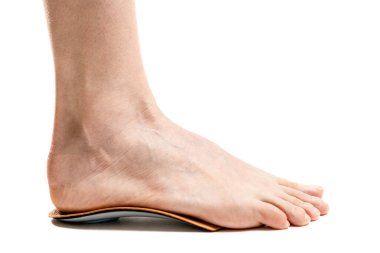 barefoot female legs, flatfeet problem