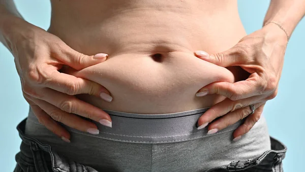 Partial View Overweight Female Belly Fat — Foto de Stock