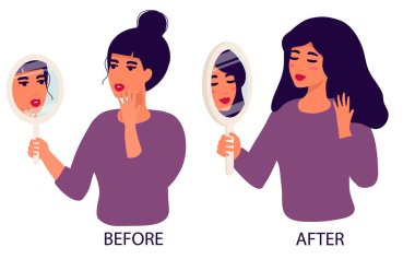 bad skin face of girl. troubled by bad condition. Beautiful Woman with Wrinkles on Face. Treatment of wrinkles. Face without Skin Problems. Clean Face Smile. Before after. flat cartoon style. Vector
