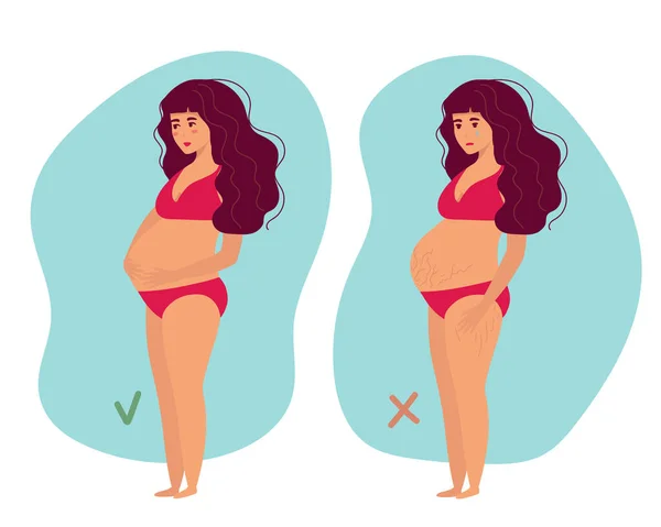 Pregnancy Belly Stretch Marks Self Love Body Positive Motherhood Preparation — Archivo Imágenes Vectoriales