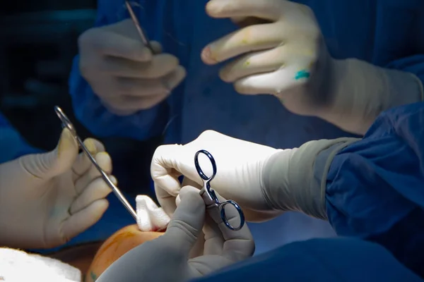 Close-up of the hands of a team of surgeons operating. Breast surgery.