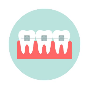 Diş telleri. Tıbbi tedavi. Gülümse Rozet. Sakız Sağlığı.