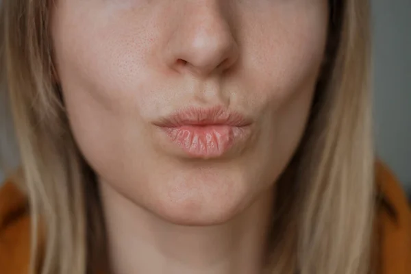 Kiss Close View Facial Expressions — Stockfoto