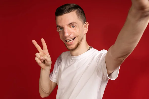 Treacher Sendromlu Beyaz Tişörtlü Genç Adam Selfie Çekiyor Engelli Insanlar — Stok fotoğraf