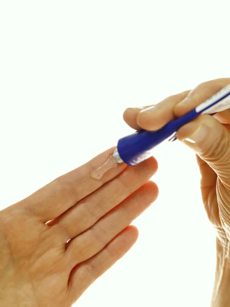 Aplicando o gel com um tubo a um dedo Conceito tópico do tratamento — Fotografia de Stock