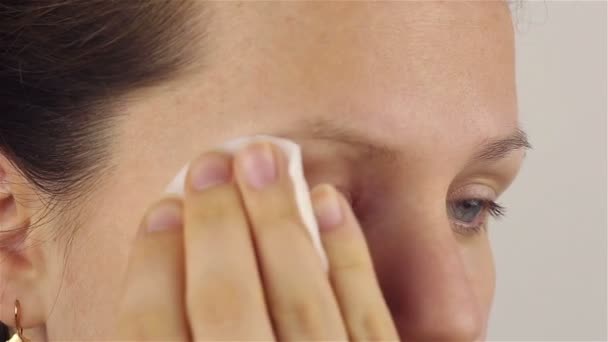 Young woman with hordeolum disease in the eye. — Stock Video