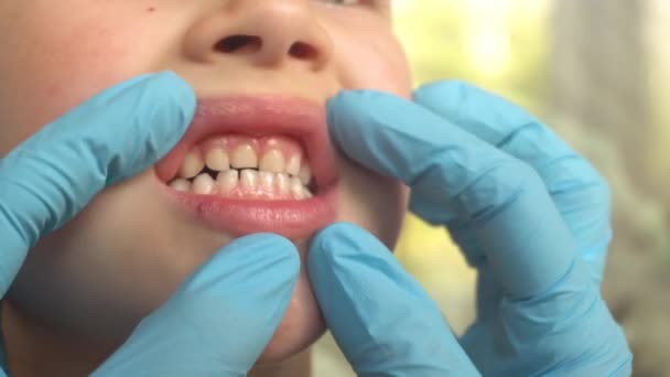 Маленькая девочка или мальчик показывает горло языком. Зубная медицина или концепция временного ухода за зубами. — стоковое видео