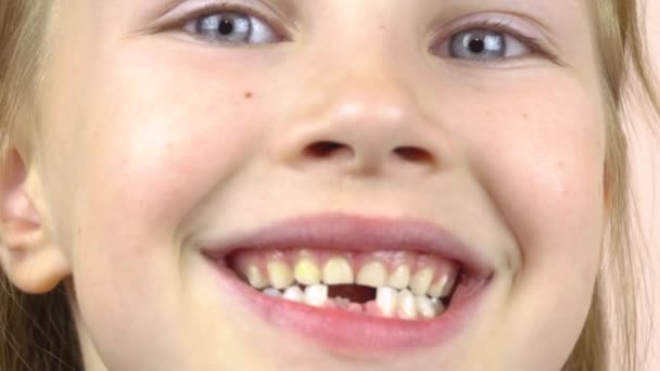 Närbild av ansiktet på en liten flicka som visar sin mun med fallna mjölktänder, grimaser. — Stockvideo