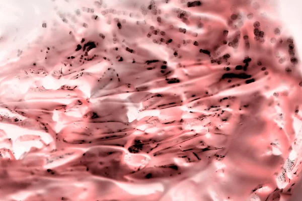 Nádory Pod Mikroskopem Tkáně Postižené Nádorovými Buňkami Pod Mikroskopem Nauka — Stock fotografie