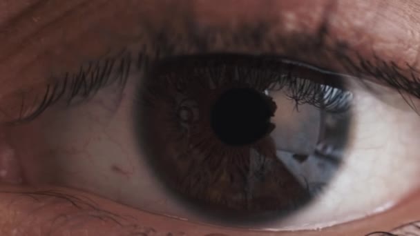 Correção da visão olho cuidados macro marrom íris cor — Vídeo de Stock