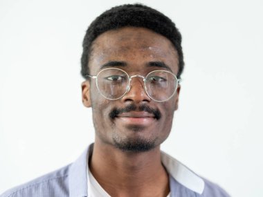 Cilt bakımı. Sivilce sorunu. Gülümsüyor.