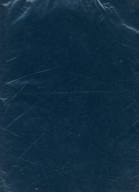 ekran arızası dijital hata koyu statik titreşim